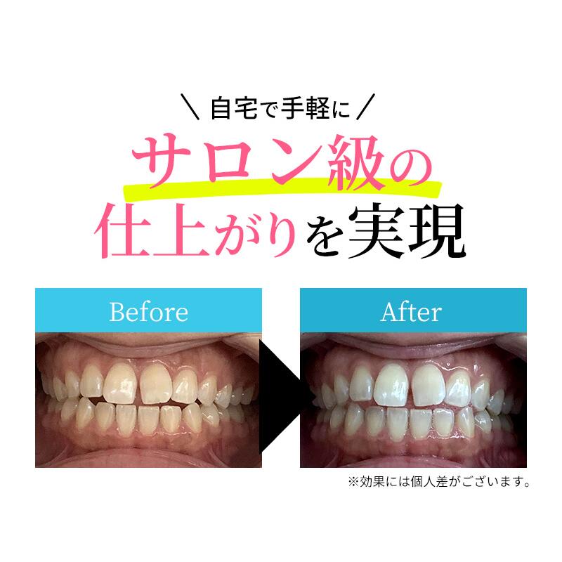 楽天市場】＼累計55,000台突破／ ホワイトニング ハンディライト LED