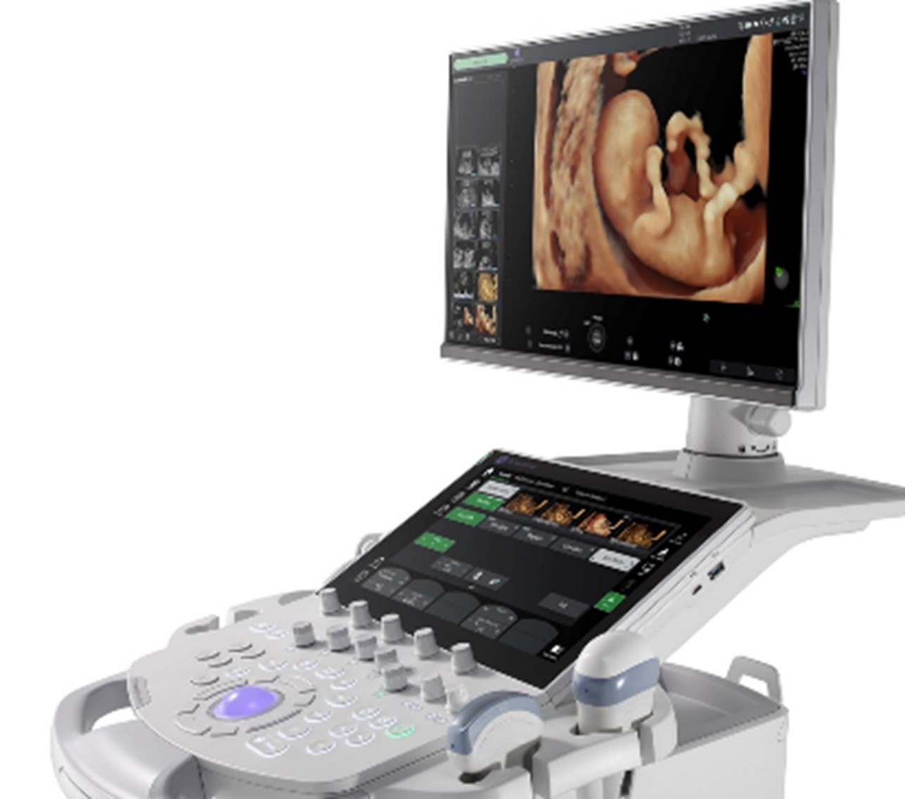 GEヘルスケア・ジャパン 産婦人科向け超音波画像診断装置「Voluson
