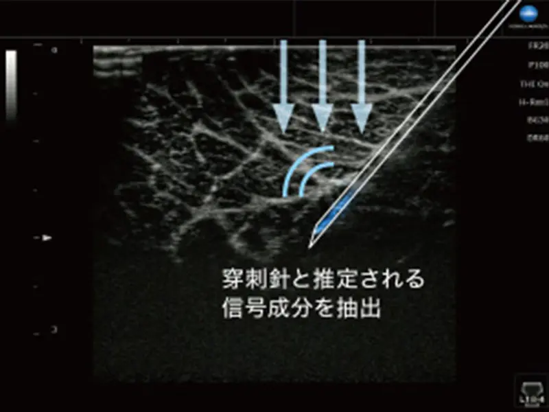 超音波診断装置 SNiBLE2 | コニカミノルタ