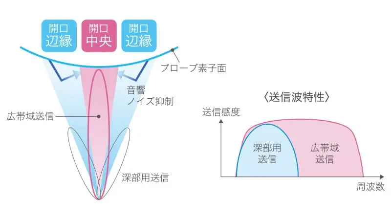超音波診断装置 SONIMAGE HS2 | コニカミノルタ