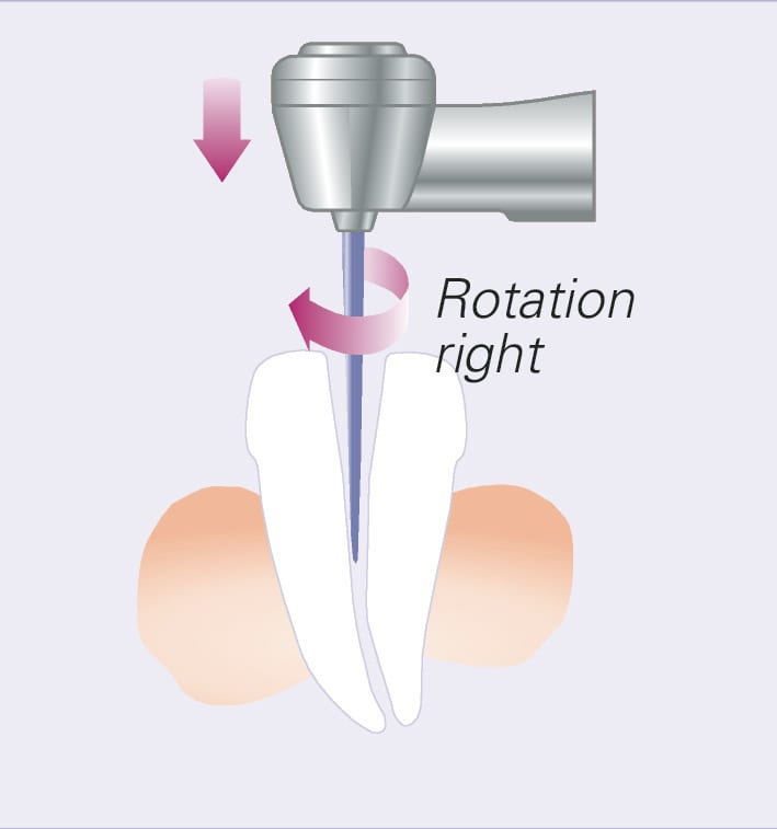 DentaPort ZX OTR | MORITA
