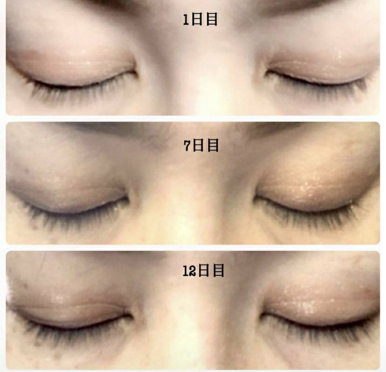 プテロ アイラッシュセラム ｜ 株式会社 タクサム｜大阪の美容