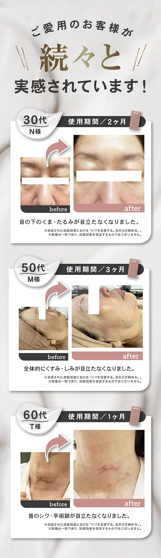 Moi Belle シワ改善美白クリーム