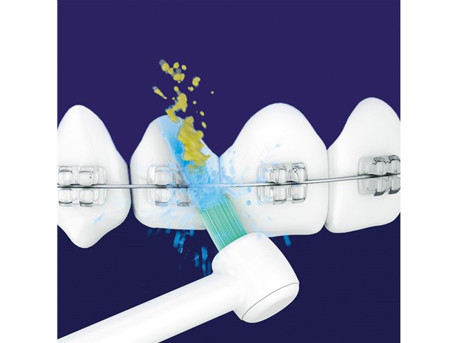 パナソニック、舌磨きノズル付属の「ジェットウォッシャー ドルツ EW