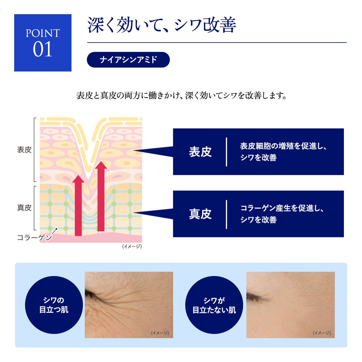 エクスバリア 薬用 ディープ リペア ゲル リンクル＆ホワイト