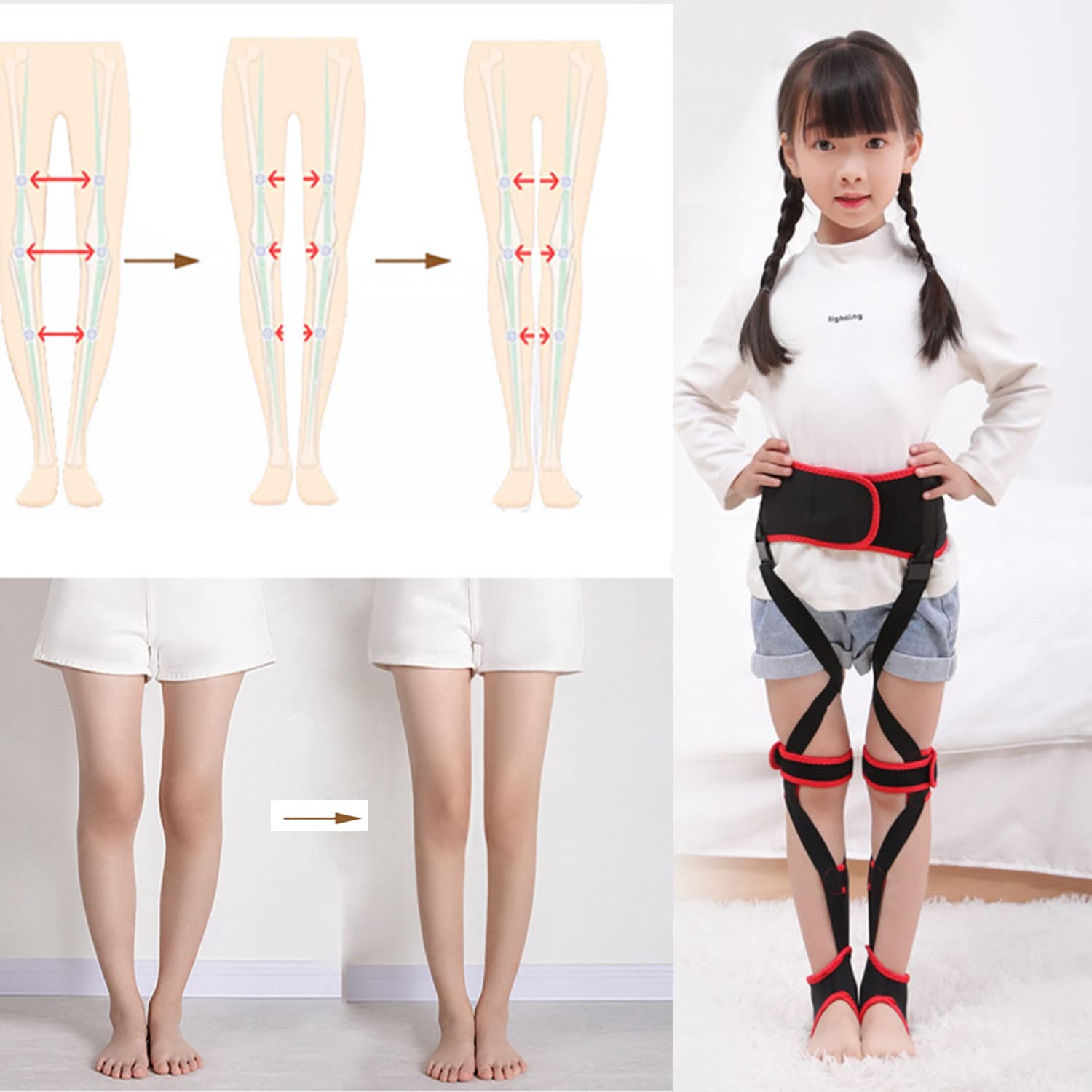 Amazon.co.jp: 子供用O脚矯正ベルト 内反膝矯正包帯矯正8文字