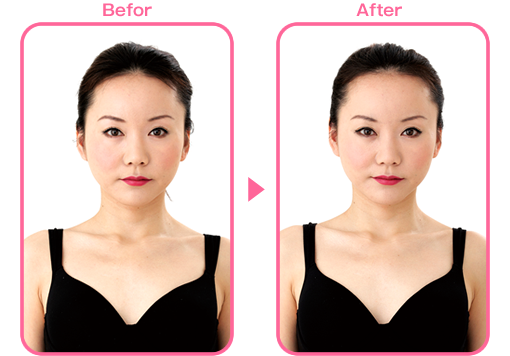 株式会社 リード モンテセラピー 製品のご案内＜モンテ リフトシーツ＞