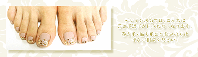 BSブレイスクイックとは？｜仙台のネイルサロン『NAIL MAJIC(ネイル