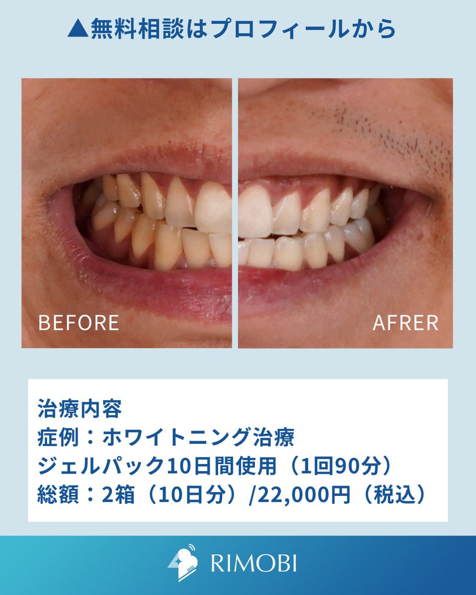 RIMOBI(リモビ)｜DENNOVATE(ディノベート)取扱 (@rimobi_dental