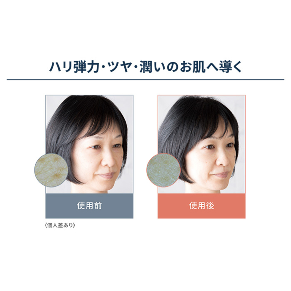 リマドス ビューティーセラム30ml4本 クリーム付ベストセラーセット